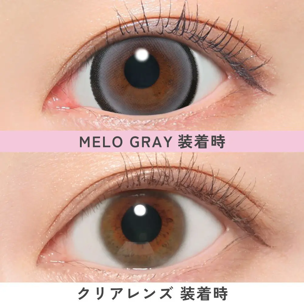 メログレー比較画像